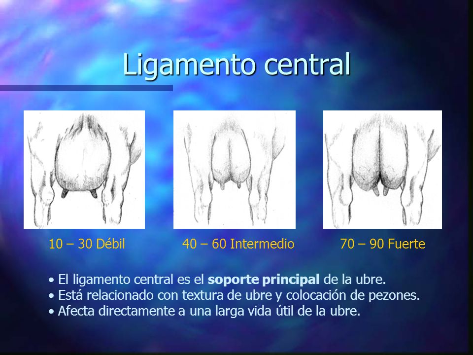 Ligamento central 10 – 30 Débil 40 – 60 Intermedio 70 – 90 Fuerte
