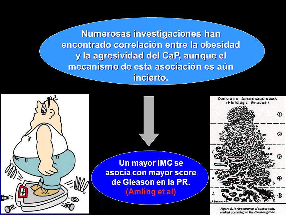 Numerosas investigaciones han encontrado correlación entre la obesidad y la agresividad del CaP, aunque el mecanismo de esta asociación es aún incierto.