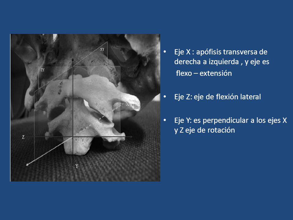 Eje X : apófisis transversa de derecha a izquierda , y eje es