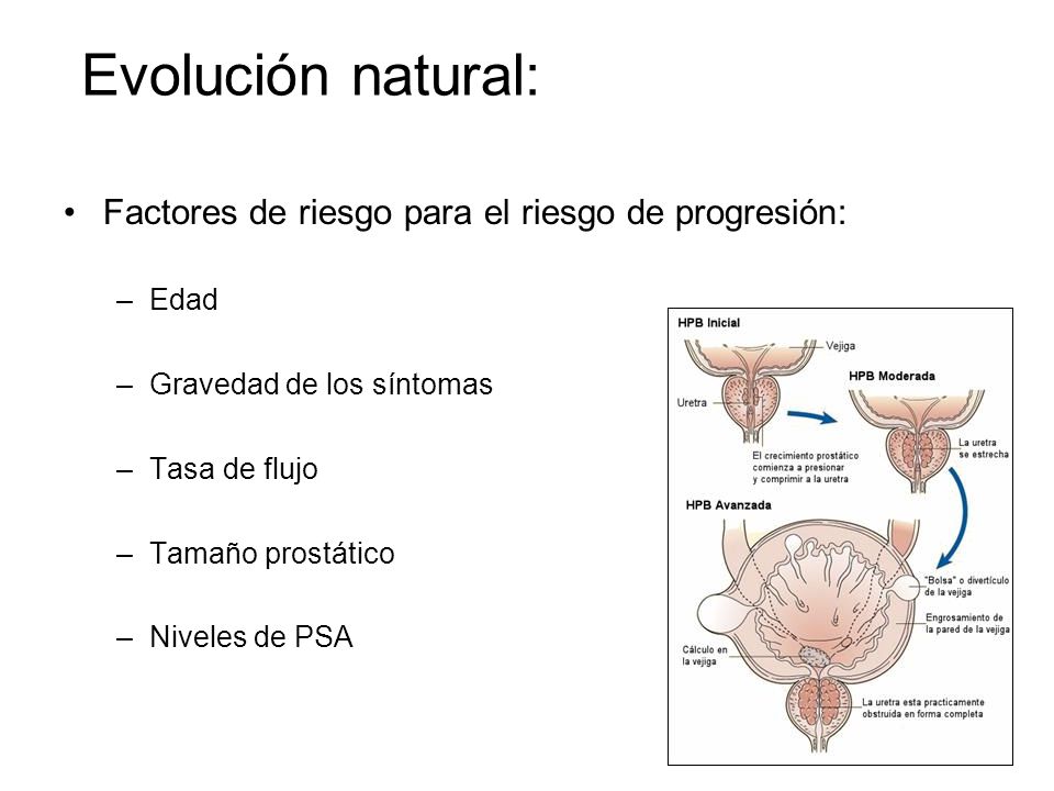 Evolución natural: Factores de riesgo para el riesgo de progresión: