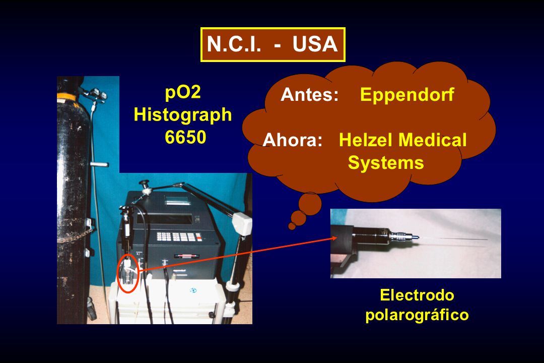 N.C.I. - USA Antes: Eppendorf pO2 Histograph Ahora: Helzel Medical