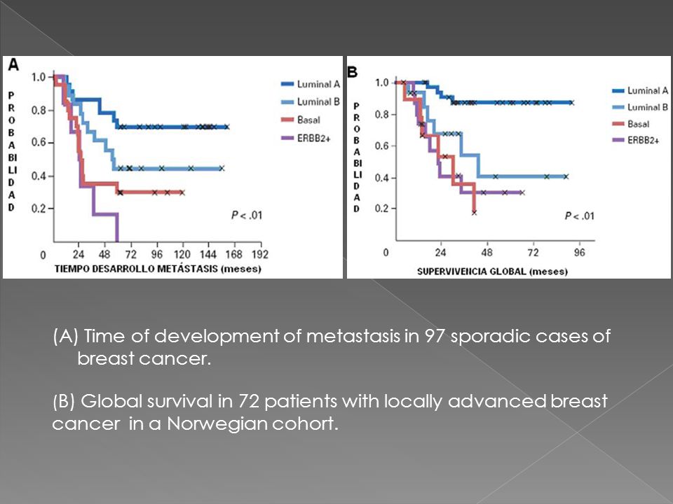 Time of development of metastasis in 97 sporadic cases of breast cancer.