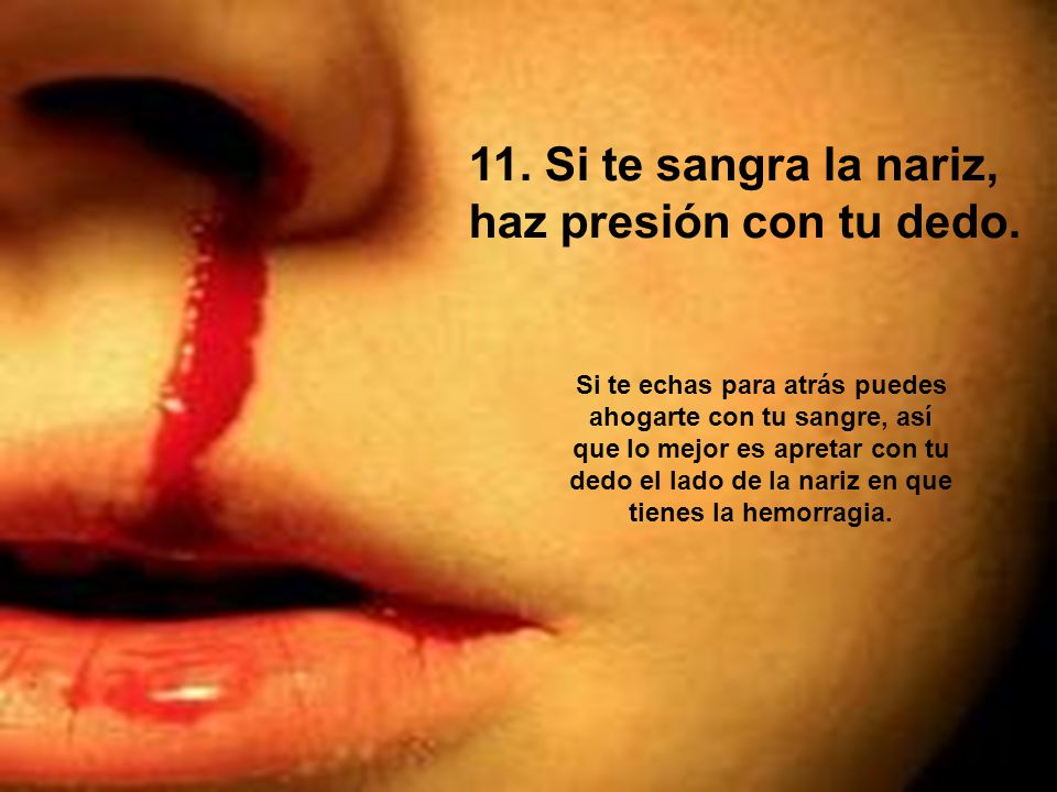 11. Si te sangra la nariz, haz presión con tu dedo.