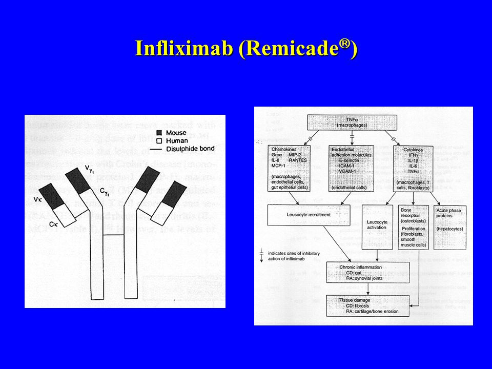 Infliximab (Remicade)