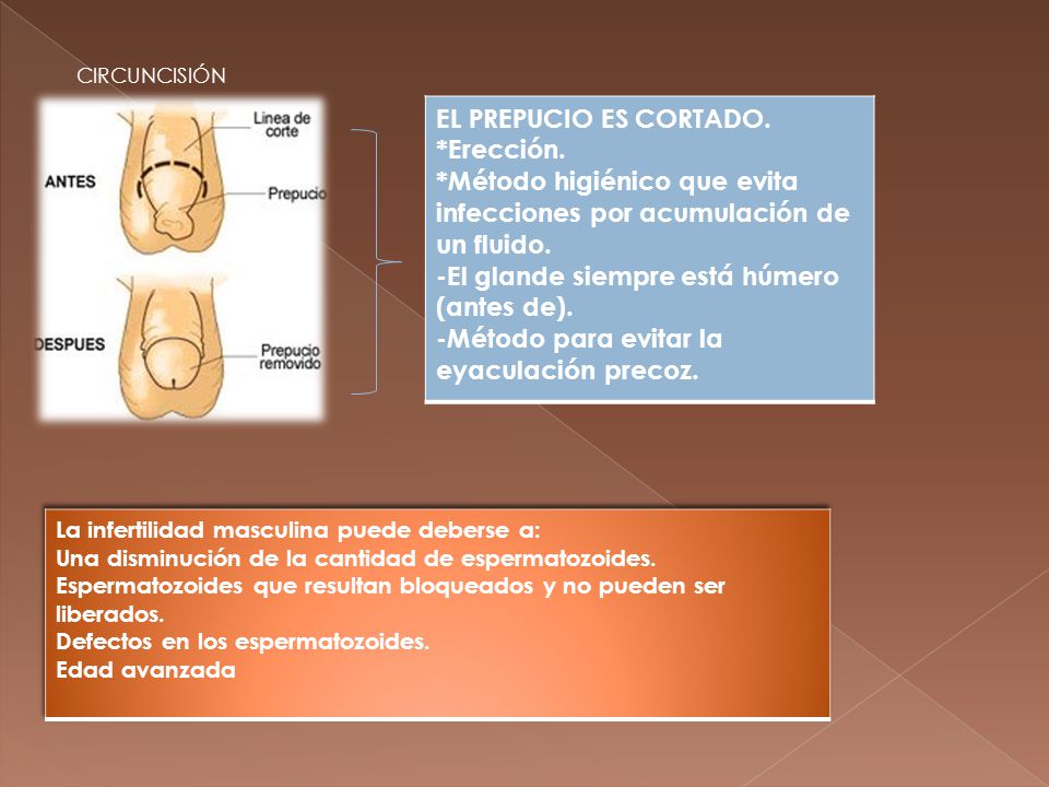 *Método higiénico que evita infecciones por acumulación de un fluido.