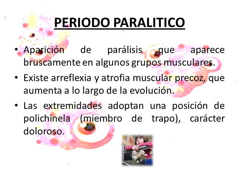 PERIODO PARALITICO Aparición de parálisis que aparece bruscamente en algunos grupos musculares.