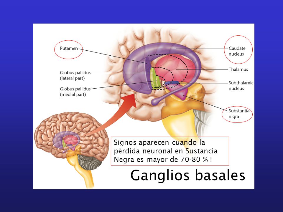 Signos aparecen cuando la pérdida neuronal en Sustancia Negra es mayor de % !