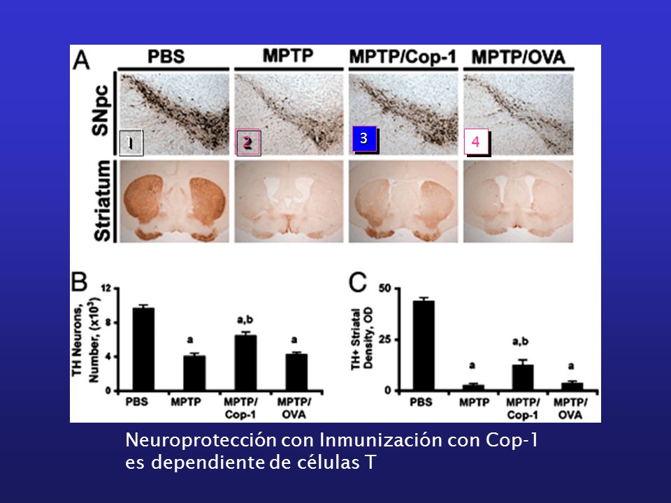 Neuroprotección con Inmunización con Cop-1 es dependiente de células T
