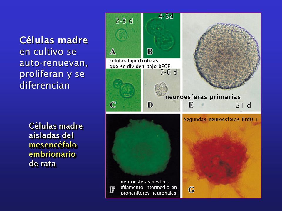 Células madre en cultivo se auto-renuevan, proliferan y se diferencian