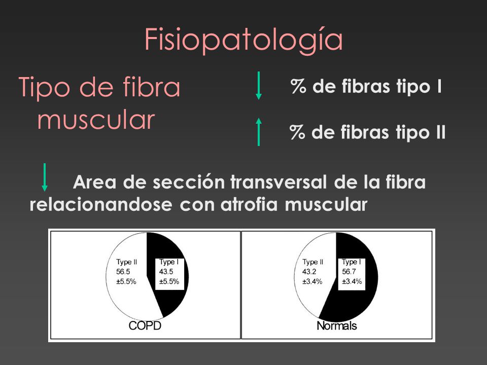 Fisiopatología Tipo de fibra muscular % de fibras tipo I