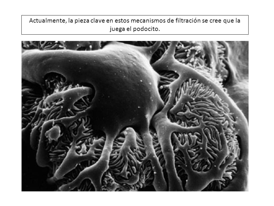 Actualmente, la pieza clave en estos mecanismos de filtración se cree que la juega el podocito.
