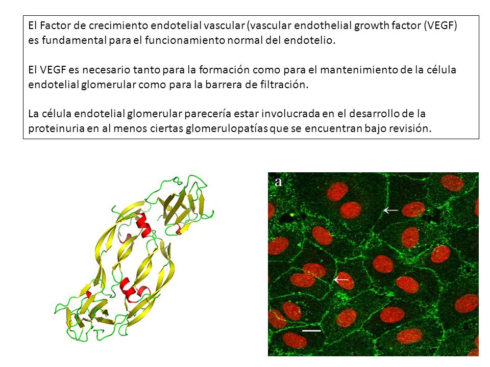 El Factor de crecimiento endotelial vascular (vascular endothelial growth factor (VEGF)