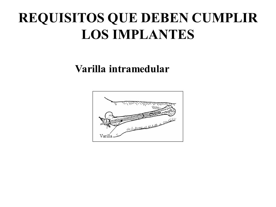 REQUISITOS QUE DEBEN CUMPLIR LOS IMPLANTES