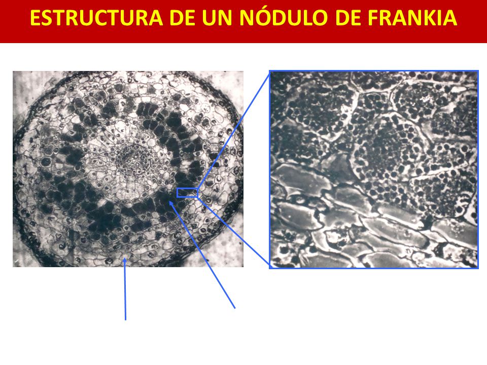 ESTRUCTURA DE UN NÓDULO DE FRANKIA