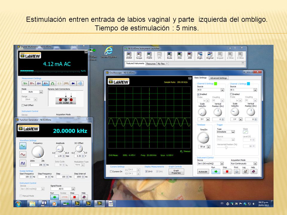 Estimulación entren entrada de labios vaginal y parte izquierda del ombligo.