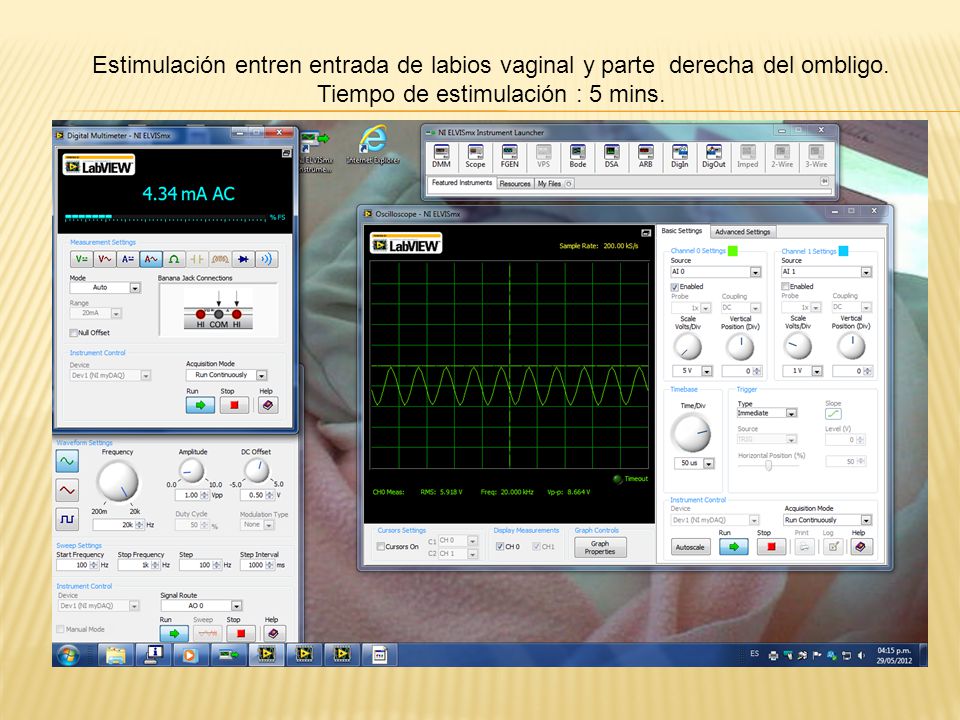 Estimulación entren entrada de labios vaginal y parte derecha del ombligo.