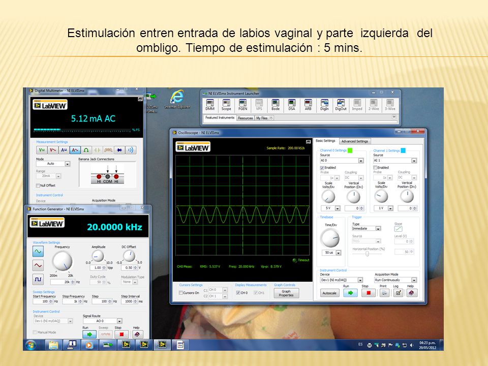 Estimulación entren entrada de labios vaginal y parte izquierda del ombligo.