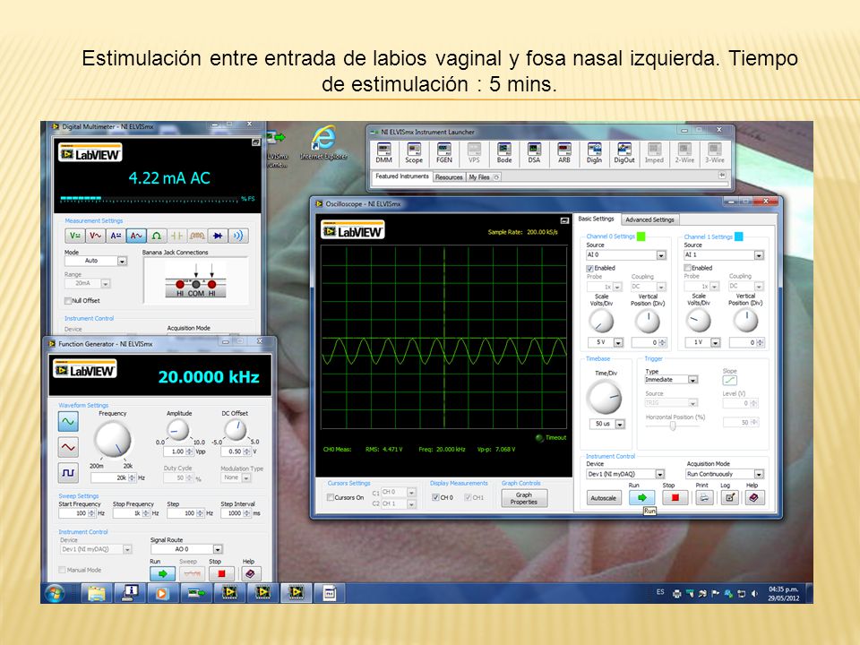 Estimulación entre entrada de labios vaginal y fosa nasal izquierda
