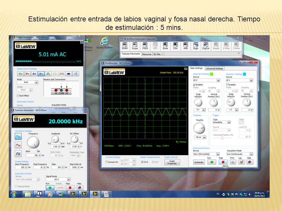 Estimulación entre entrada de labios vaginal y fosa nasal derecha