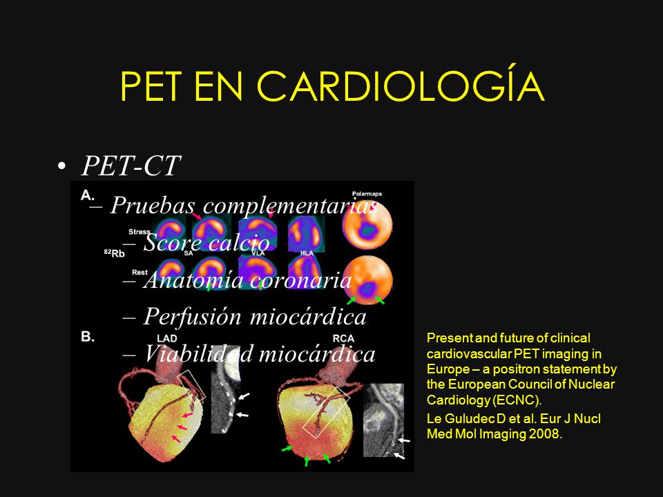 PET EN CARDIOLOGÍA PET-CT Pruebas complementarias Score calcio