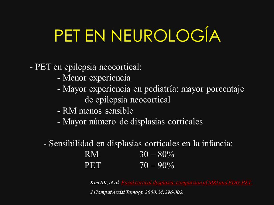 PET EN NEUROLOGÍA - PET en epilepsia neocortical: - Menor experiencia