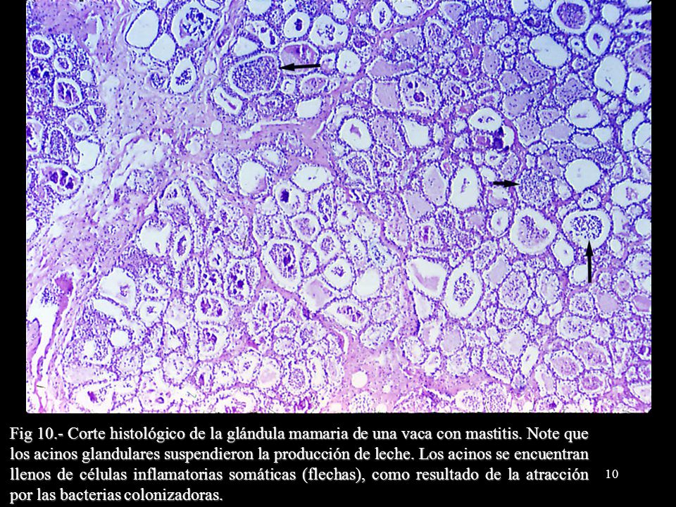 Fig 10.- Corte histológico de la glándula mamaria de una vaca con mastitis.