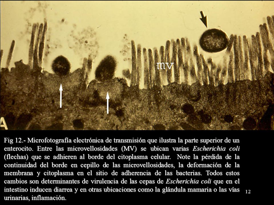 Fig 12.- Microfotografía electrónica de transmisión que ilustra la parte superior de un enterocito.