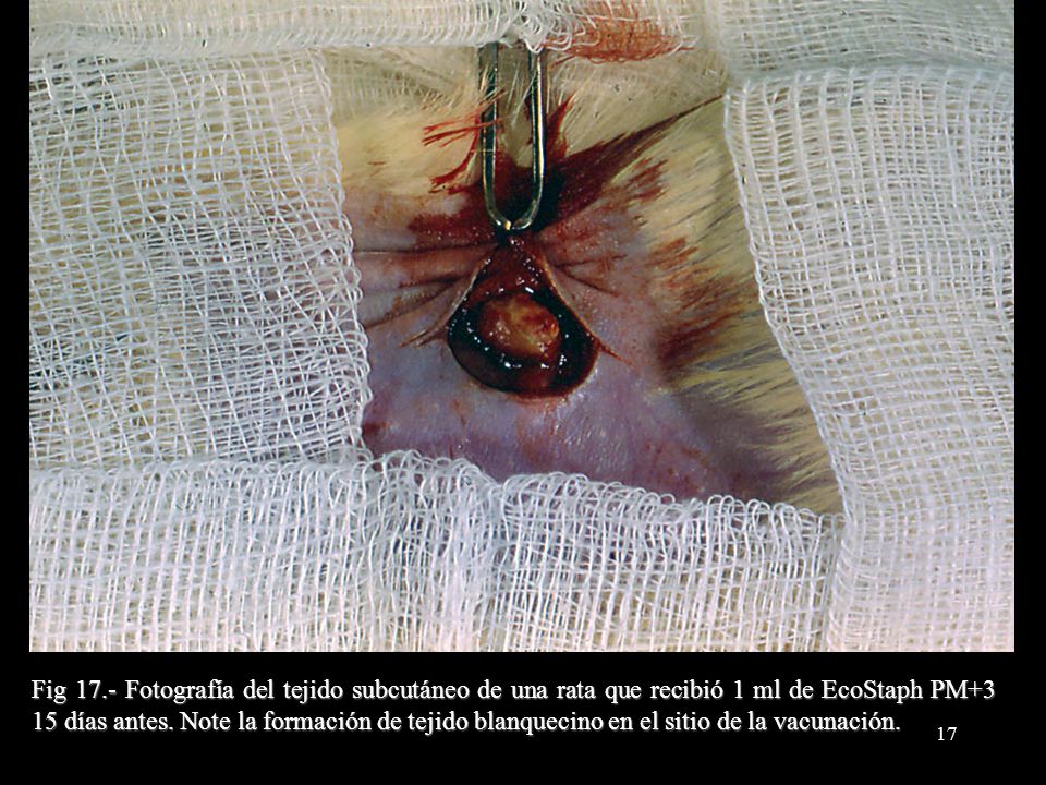 Fig 17.- Fotografía del tejido subcutáneo de una rata que recibió 1 ml de EcoStaph PM+3 15 días antes.