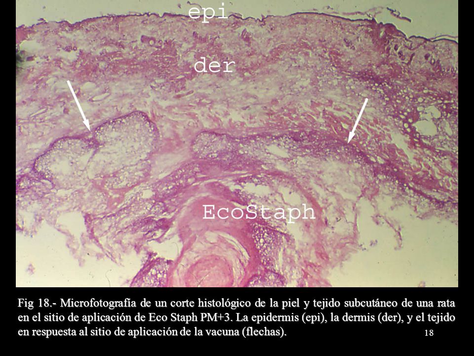 Fig 18.- Microfotografía de un corte histológico de la piel y tejido subcutáneo de una rata en el sitio de aplicación de Eco Staph PM+3.