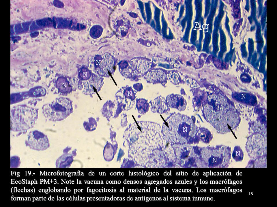 Fig 19.- Microfotografía de un corte histológico del sitio de aplicación de EcoStaph PM+3.