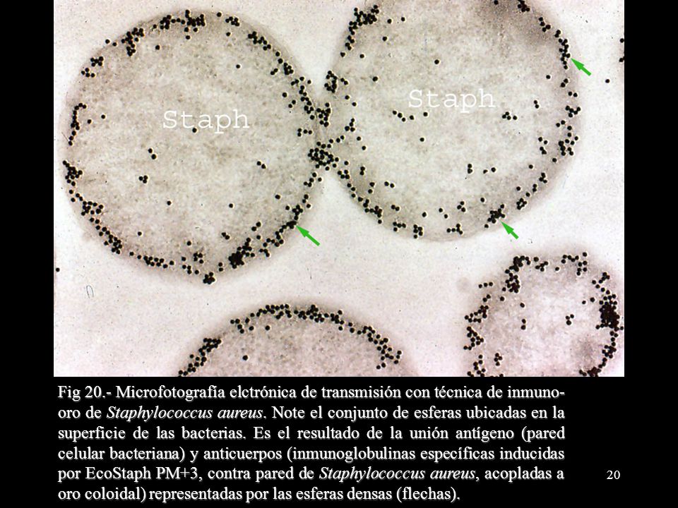 Fig 20.- Microfotografía elctrónica de transmisión con técnica de inmuno-oro de Staphylococcus aureus.