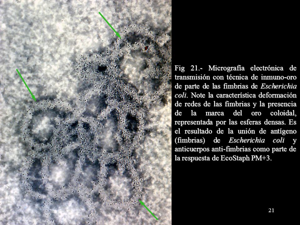 Fig 21.- Micrografía electrónica de transmisión con técnica de inmuno-oro de parte de las fimbrias de Escherichia coli.