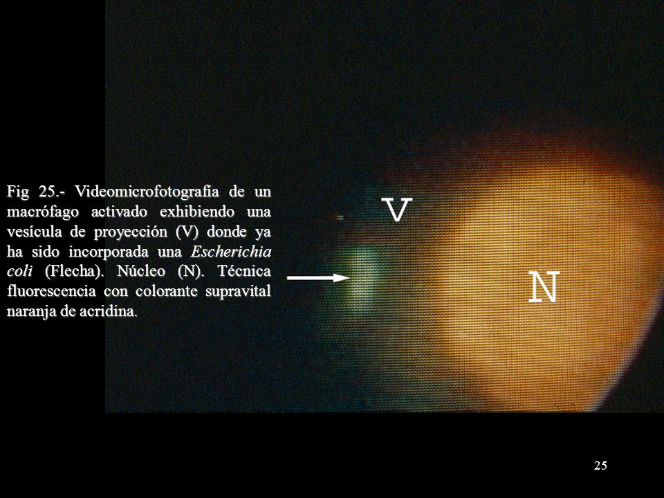 Fig 25.- Videomicrofotografía de un macrófago activado exhibiendo una vesícula de proyección (V) donde ya ha sido incorporada una Escherichia coli (Flecha).
