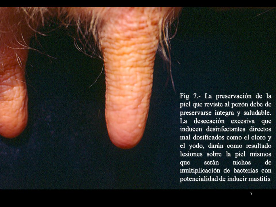 Fig 7.- La preservación de la piel que reviste al pezón debe de preservarse integra y saludable.
