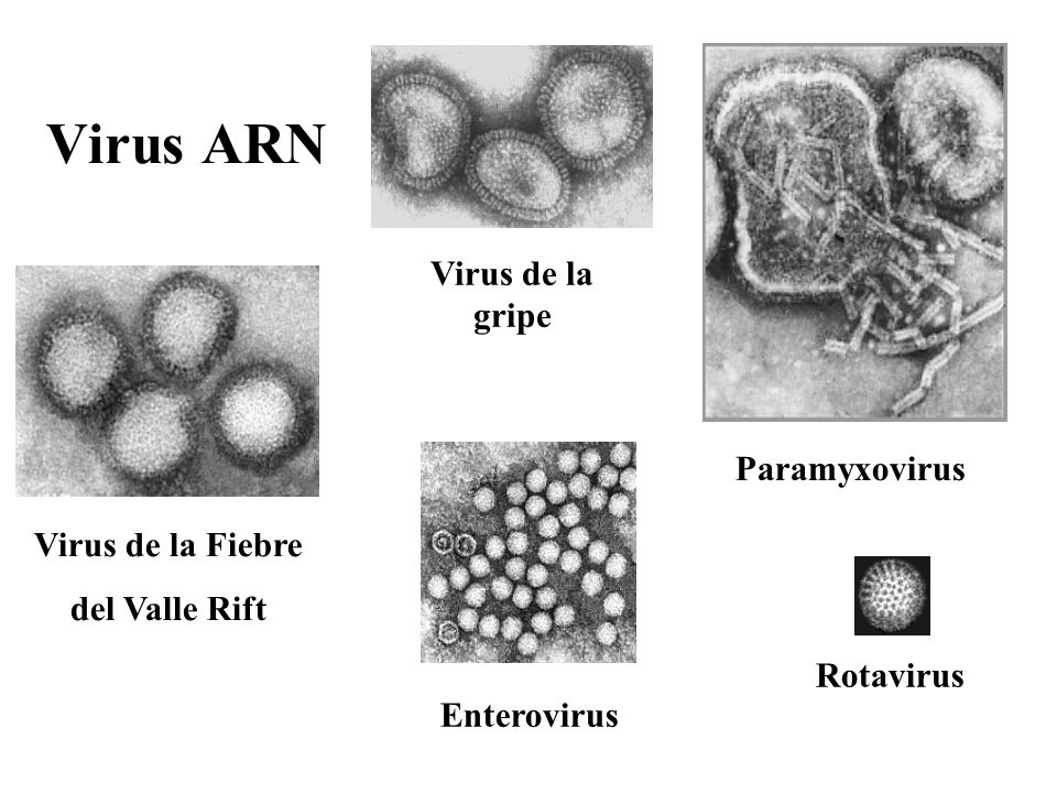 Virus ARN Virus de la gripe Paramyxovirus Virus de la Fiebre