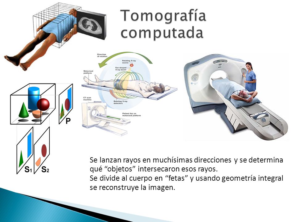 Tomografía computada Se lanzan rayos en muchísimas direcciones y se determina qué objetos intersecaron esos rayos.