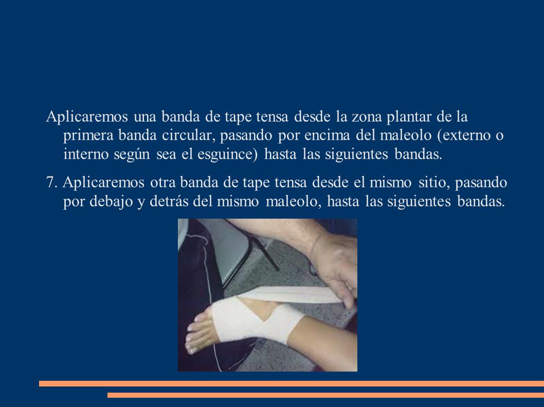 Aplicaremos una banda de tape tensa desde la zona plantar de la primera banda circular, pasando por encima del maleolo (externo o interno según sea el esguince) hasta las siguientes bandas.
