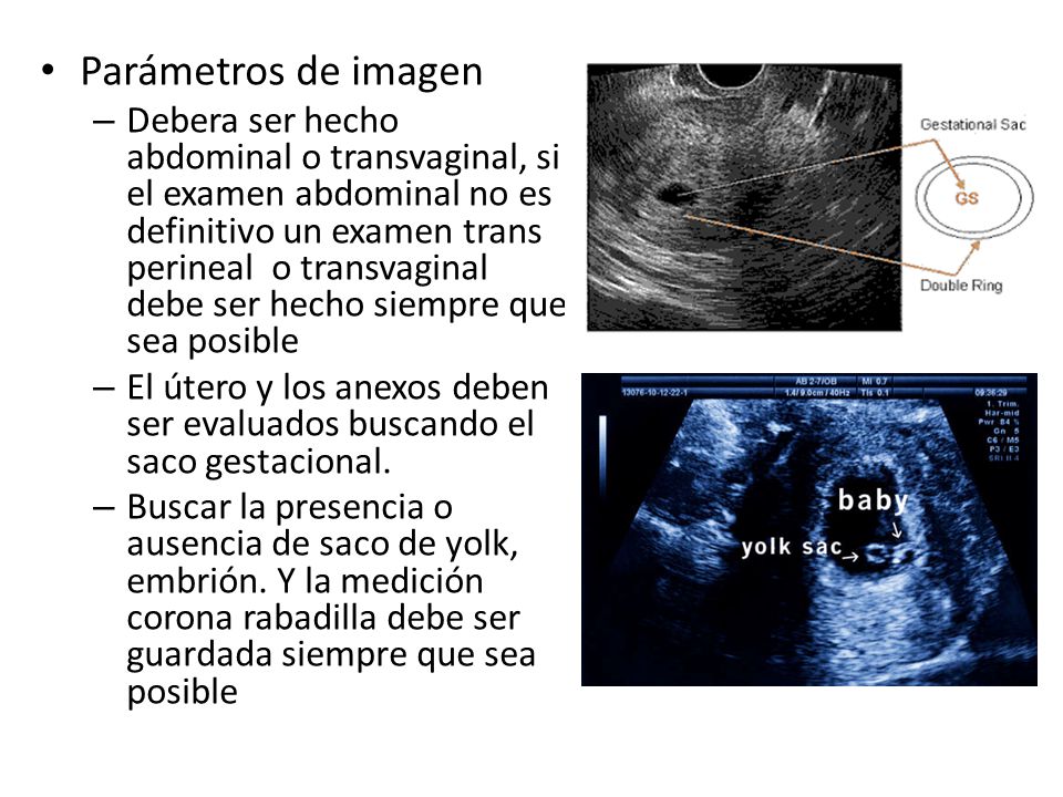 Parámetros de imagen