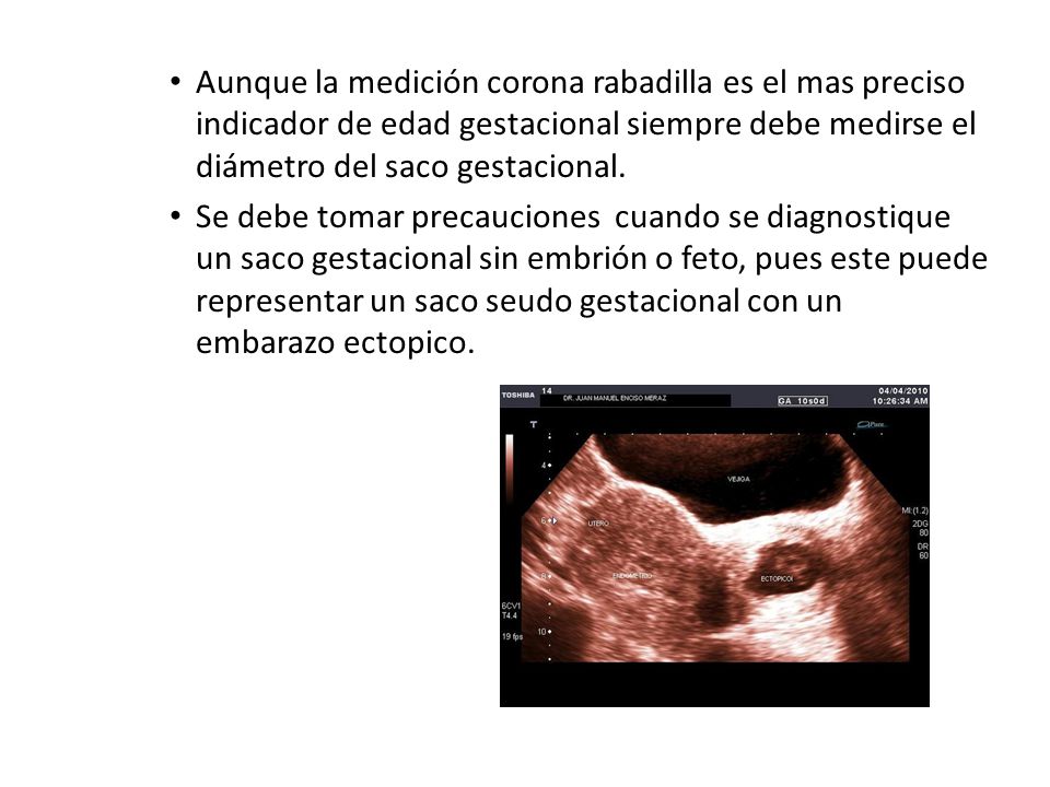 Aunque la medición corona rabadilla es el mas preciso indicador de edad gestacional siempre debe medirse el diámetro del saco gestacional.