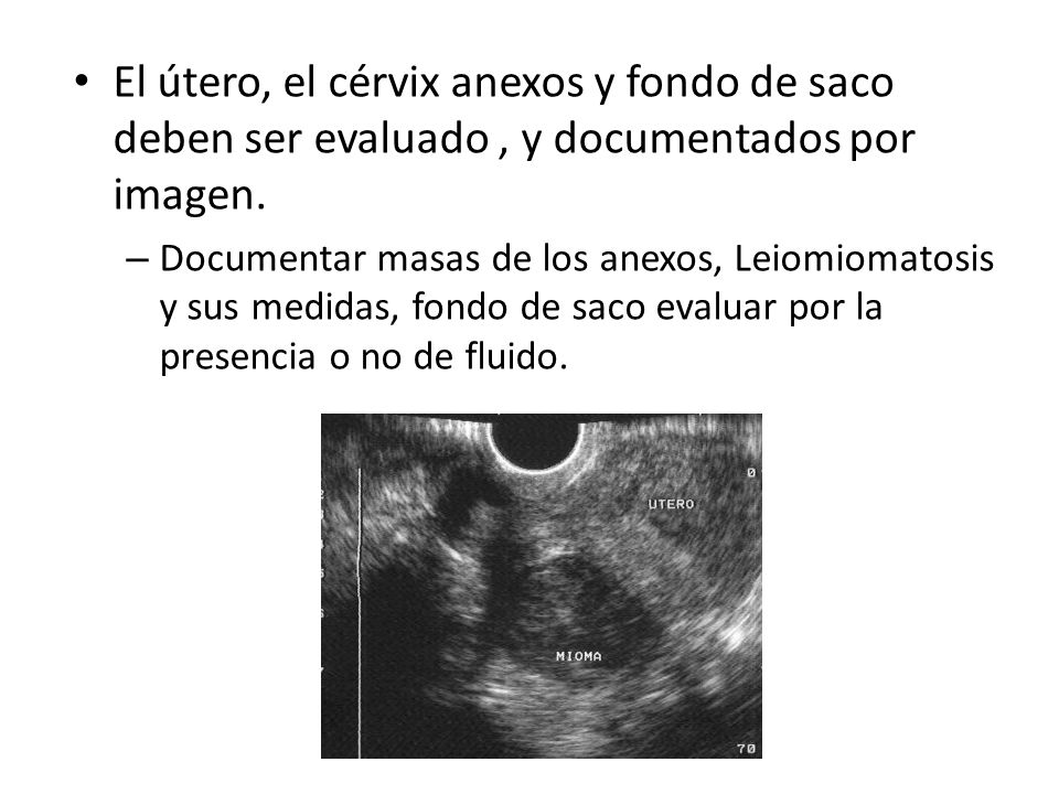 El útero, el cérvix anexos y fondo de saco deben ser evaluado , y documentados por imagen.