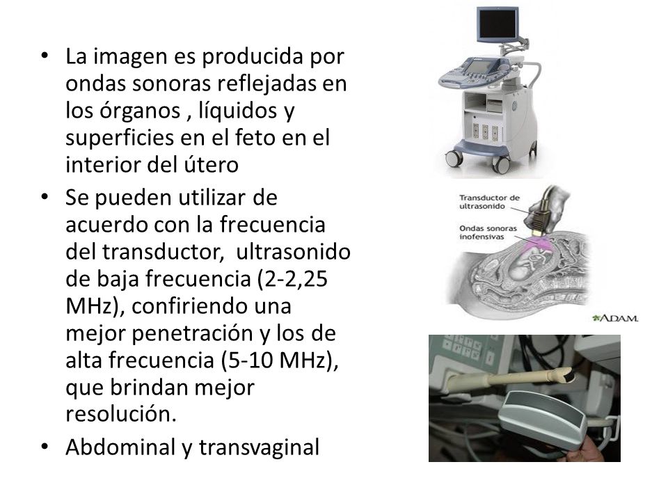 La imagen es producida por ondas sonoras reflejadas en los órganos , líquidos y superficies en el feto en el interior del útero