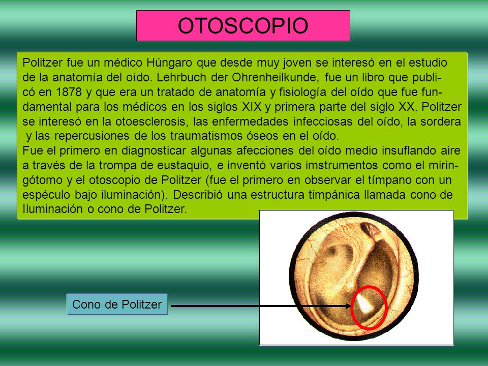 OTOSCOPIO Politzer fue un médico Húngaro que desde muy joven se interesó en el estudio.