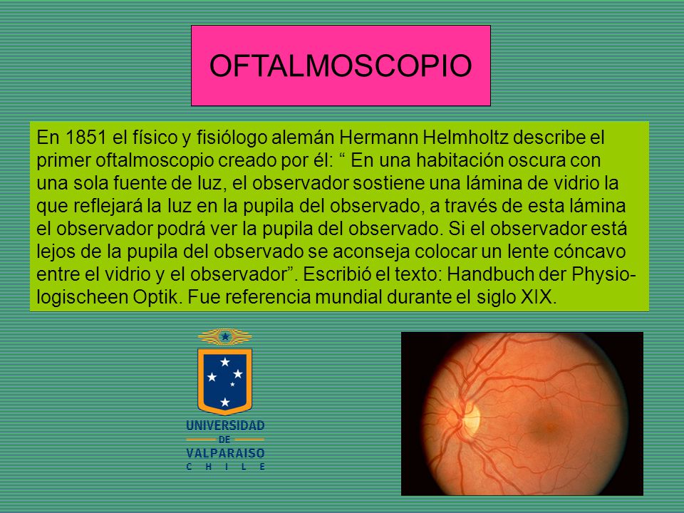 OFTALMOSCOPIO En 1851 el físico y fisiólogo alemán Hermann Helmholtz describe el. primer oftalmoscopio creado por él: En una habitación oscura con.
