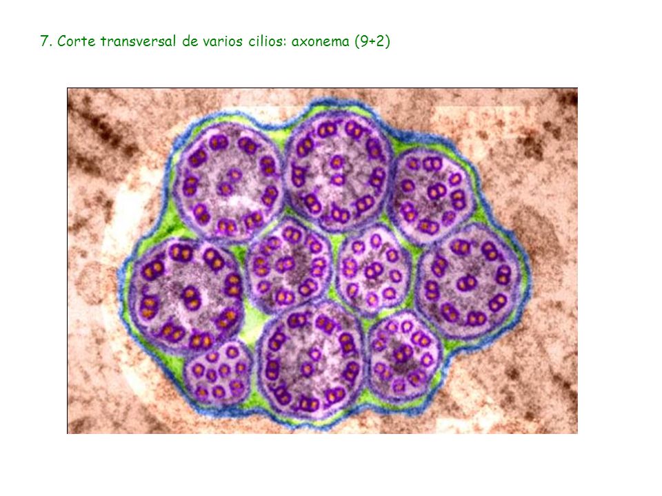 7. Corte transversal de varios cilios: axonema (9+2)