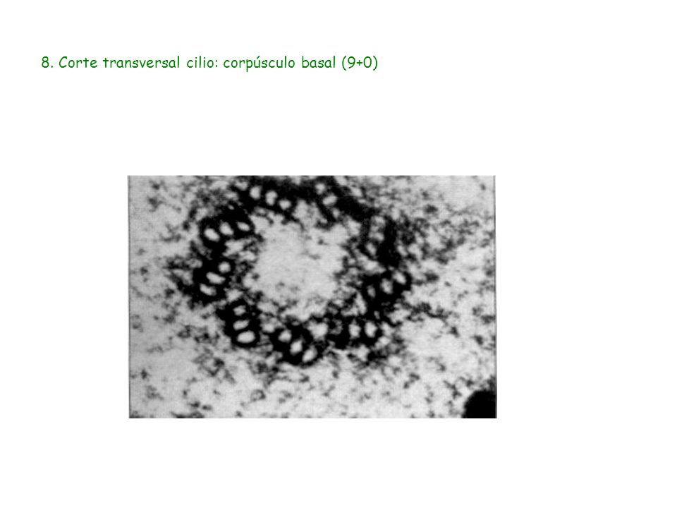 8. Corte transversal cilio: corpúsculo basal (9+0)