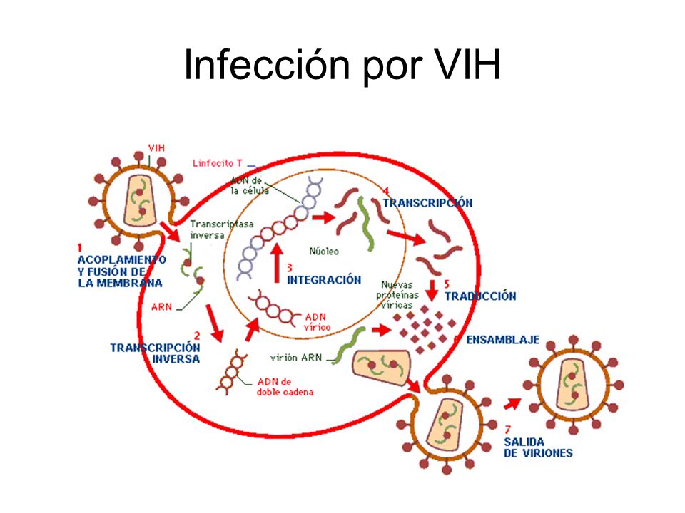 Infección por VIH