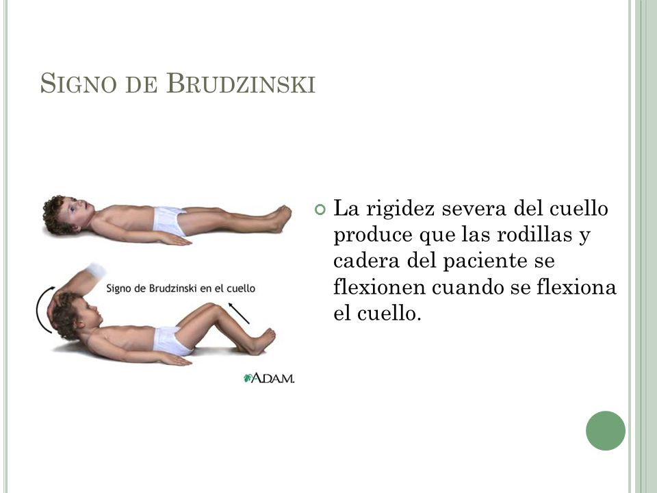 Signo de Brudzinski La rigidez severa del cuello produce que las rodillas y cadera del paciente se flexionen cuando se flexiona el cuello.