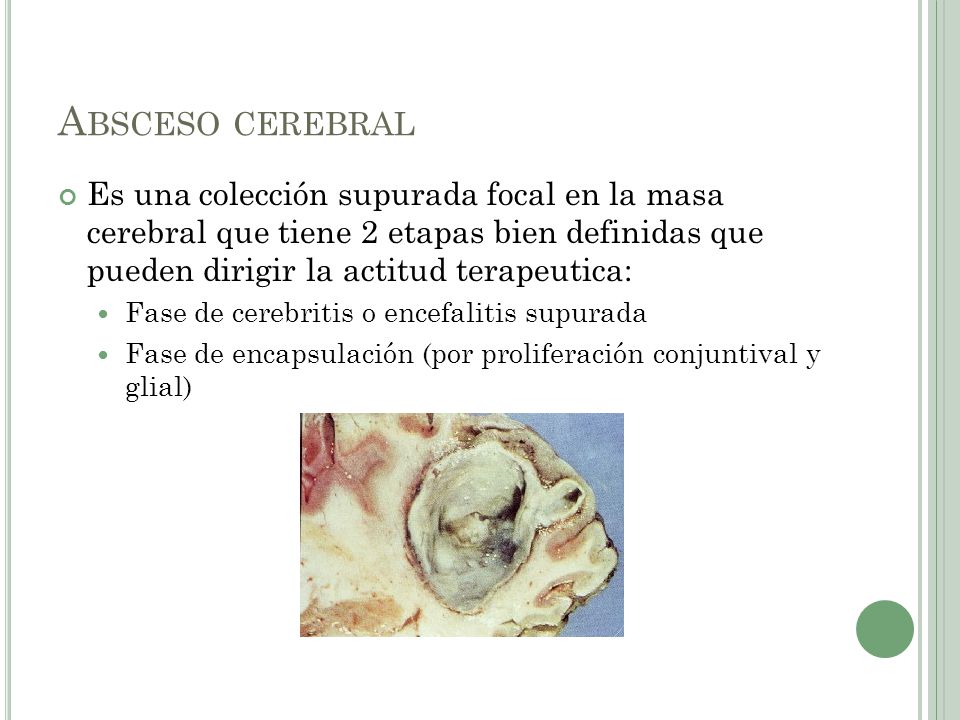 Absceso cerebral Es una colección supurada focal en la masa cerebral que tiene 2 etapas bien definidas que pueden dirigir la actitud terapeutica: