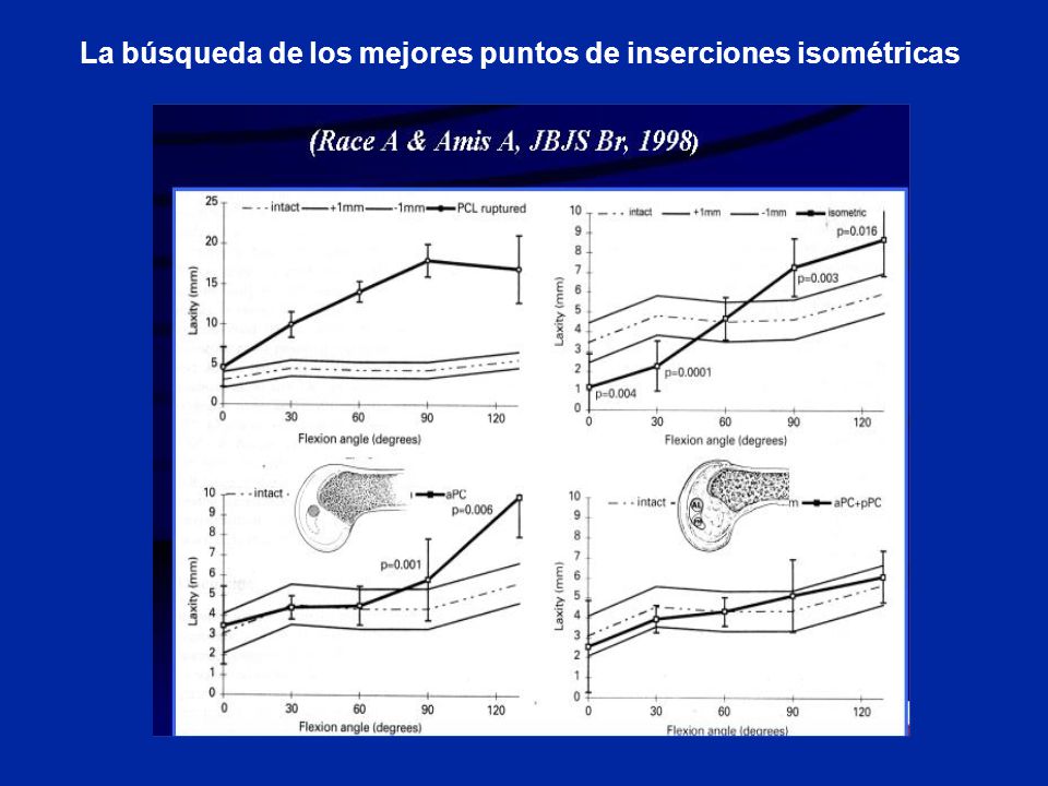 La búsqueda de los mejores puntos de inserciones isométricas