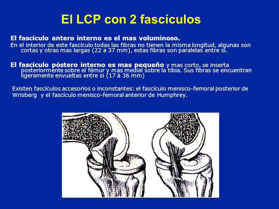 El LCP con 2 fascículos El fascículo antero interno es el mas voluminoso.